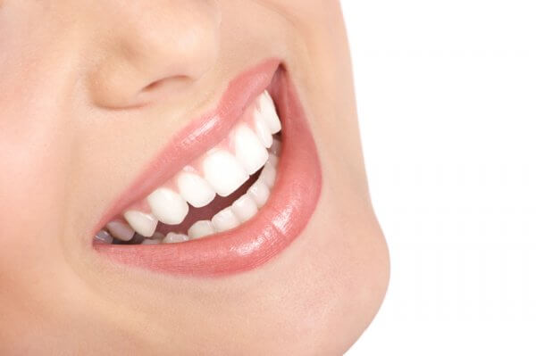 take-home teeth whitening
